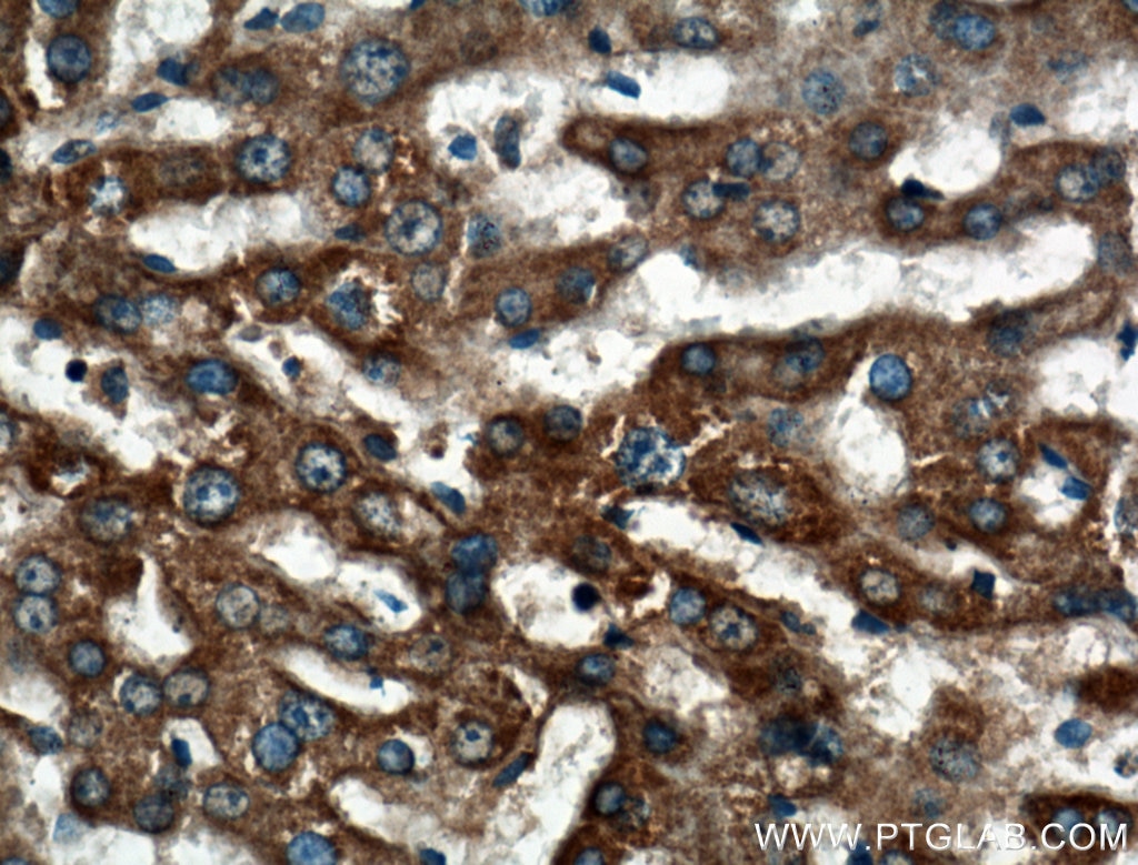 Immunohistochemistry (IHC) staining of human liver tissue using PACS2-Specific Polyclonal antibody (19508-1-AP)