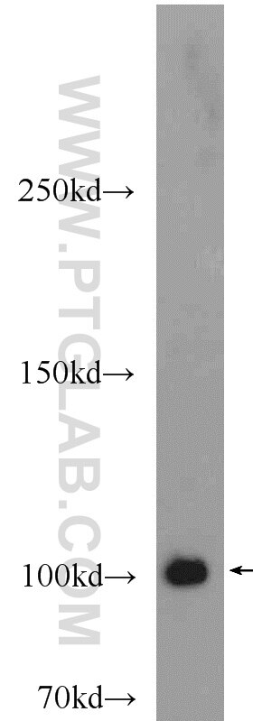 Western Blot (WB) analysis of mouse brain tissue using PACS2-Specific Polyclonal antibody (19508-1-AP)