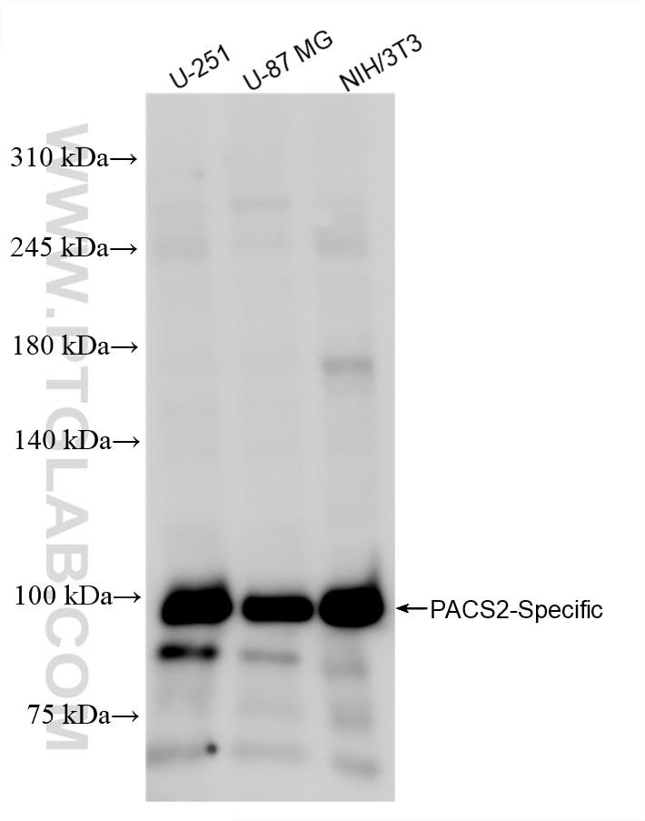 Various lysates were subjected to SDS PAGE followed by western blot with 85696-2-RR (PACS2-Specific antibody) at dilution of 1:1000 incubated at room temperature for 1.5 hours. Western Blot (WB) analysis of various lysates using PACS2-Specific Recombinant antibody (85696-2-RR)