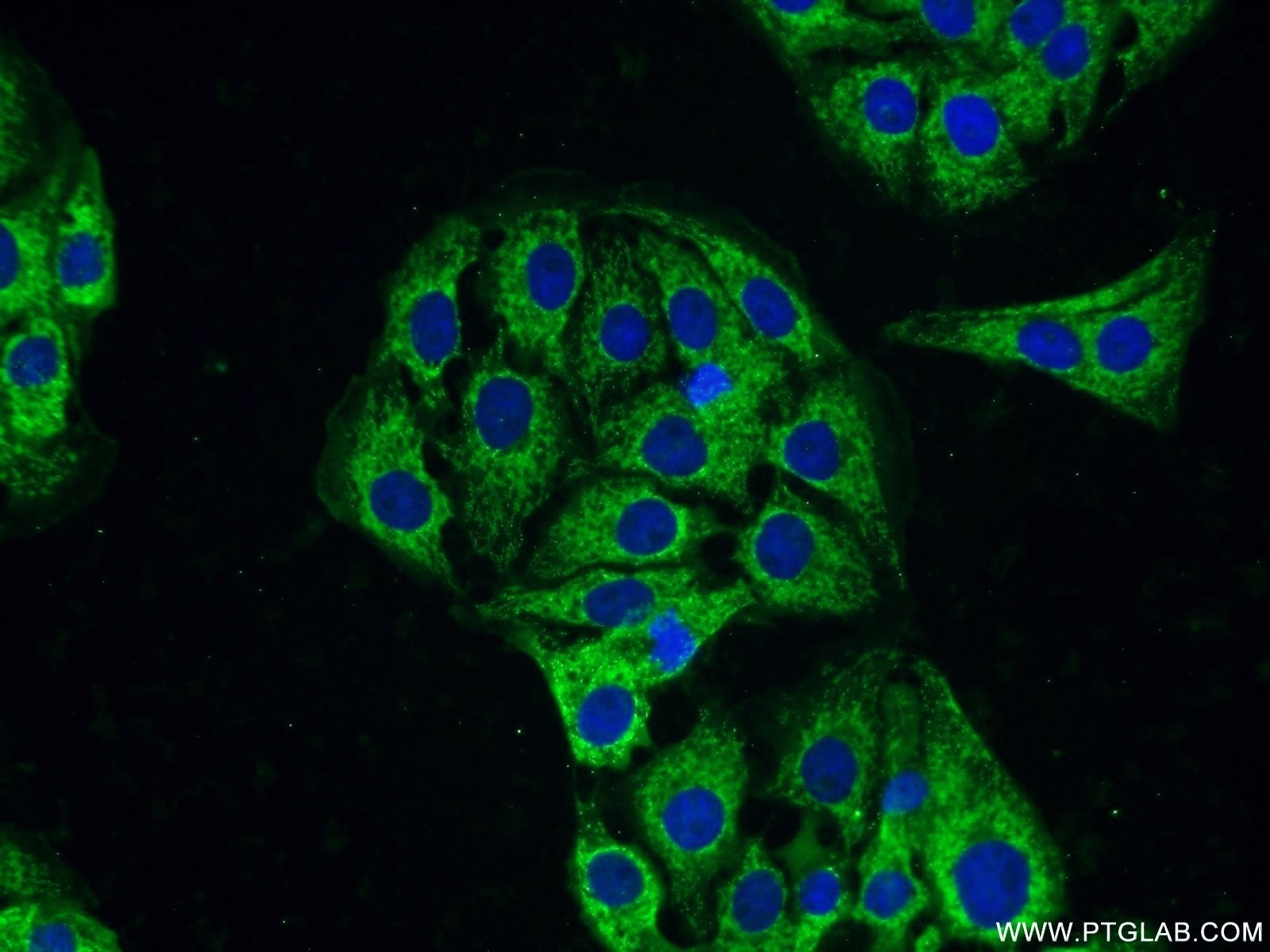 Immunofluorescence (IF) / fluorescent staining of SH-SY5Y cells using PACSIN1 Polyclonal antibody (13219-1-AP)