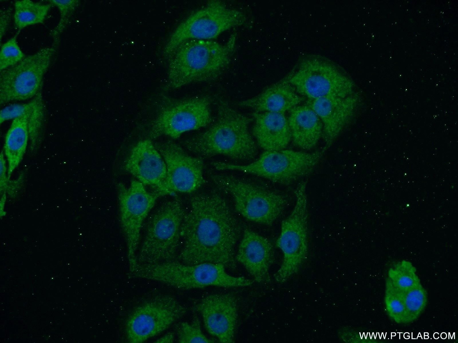 Immunofluorescence (IF) / fluorescent staining of SH-SY5Y cells using PACSIN1 Polyclonal antibody (13219-1-AP)