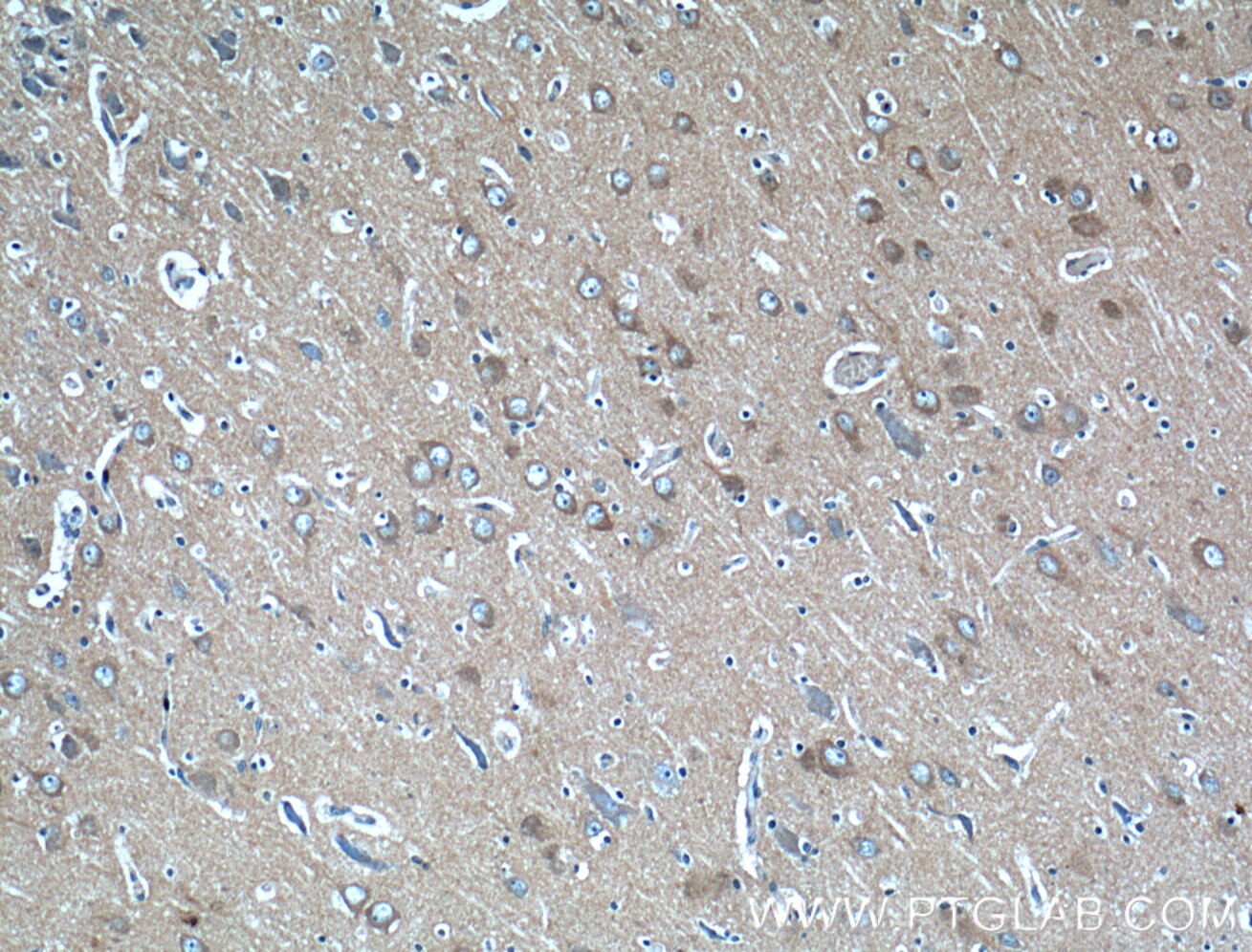 Immunohistochemistry (IHC) staining of human brain tissue using PACSIN1 Polyclonal antibody (13219-1-AP)