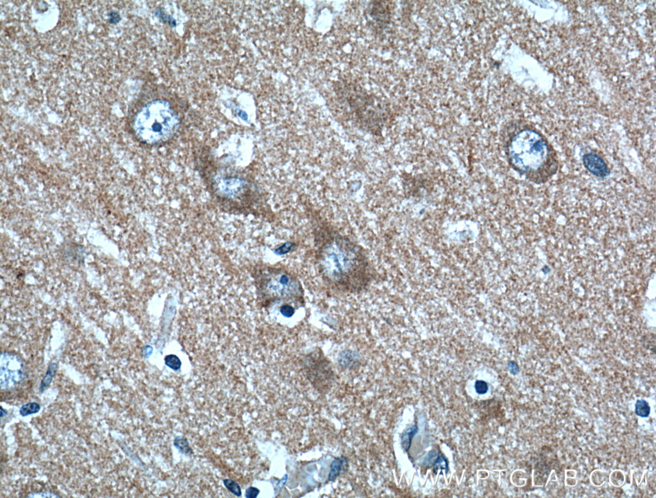 Immunohistochemistry (IHC) staining of human brain tissue using PACSIN1 Polyclonal antibody (13219-1-AP)