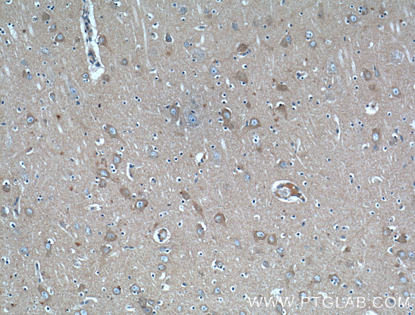 Immunohistochemistry (IHC) staining of human brain tissue using PACSIN1 Polyclonal antibody (13219-1-AP)