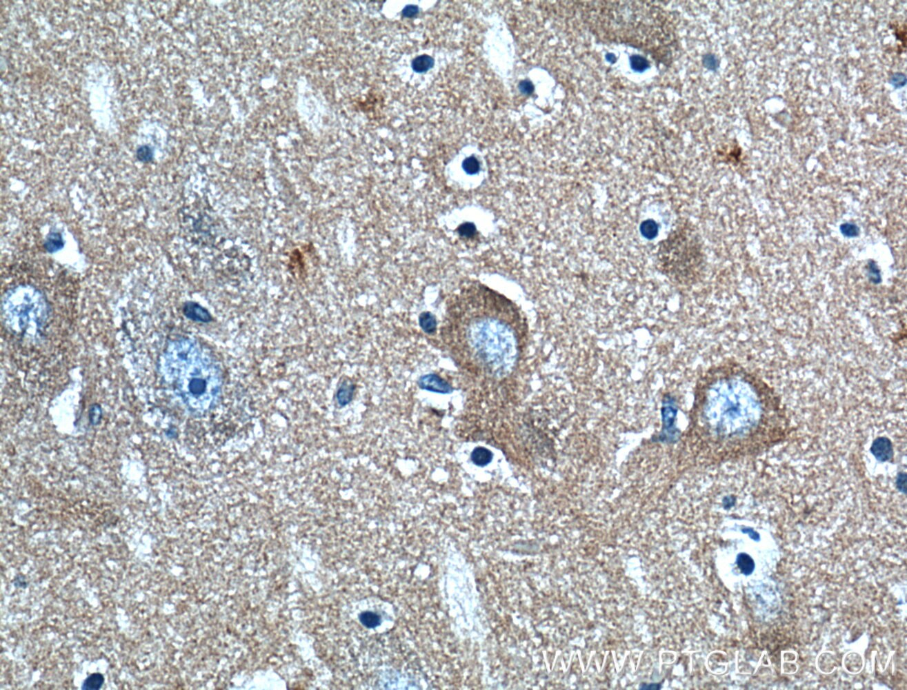 IHC staining of human brain using 13219-1-AP