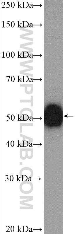 Western Blot (WB) analysis of mouse brain tissue using PACSIN1 Polyclonal antibody (13219-1-AP)