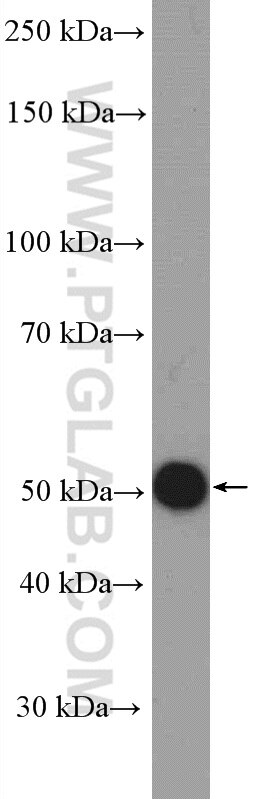 Western Blot (WB) analysis of mouse cerebellum tissue using PACSIN1 Polyclonal antibody (13219-1-AP)