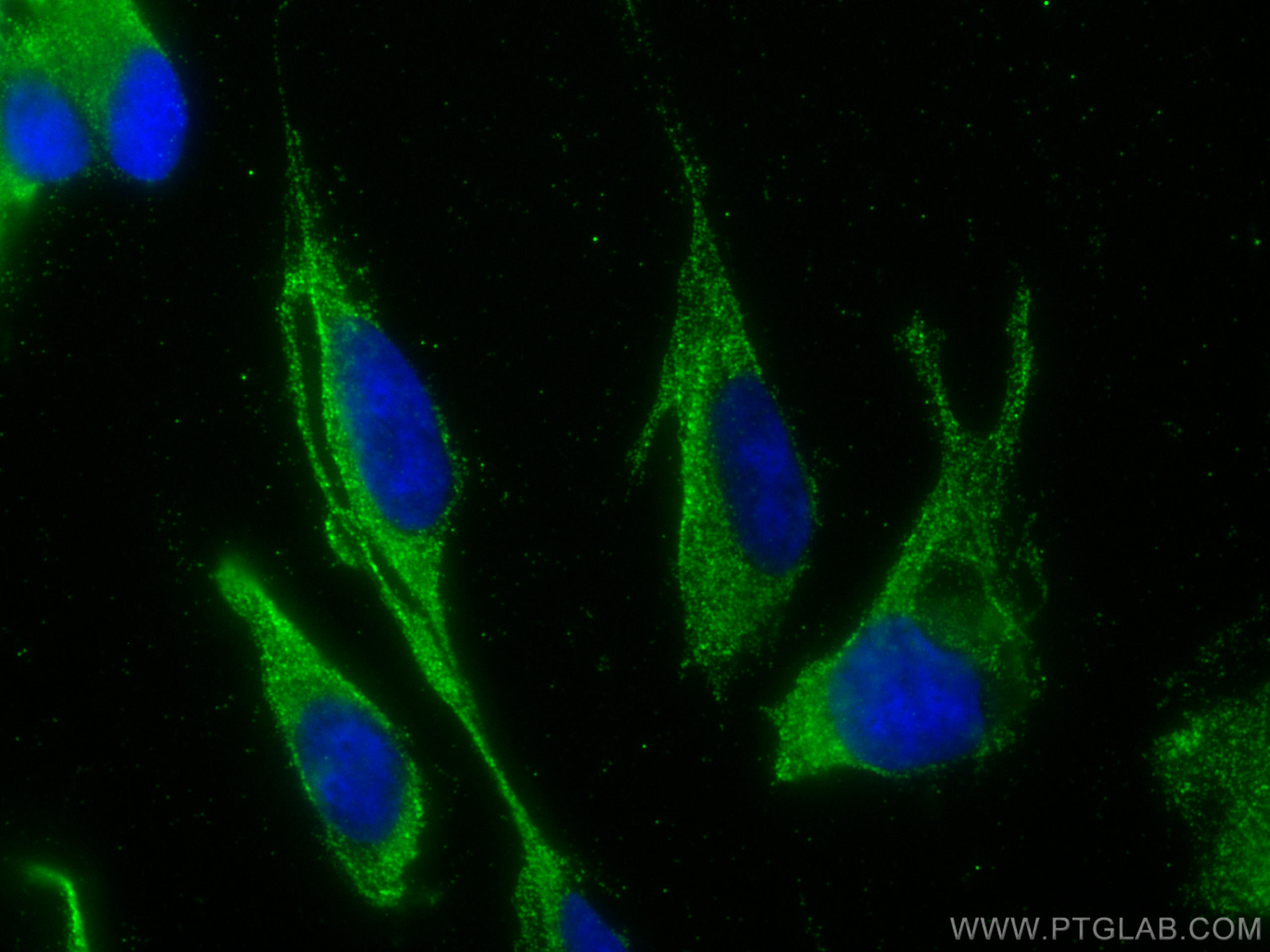 Immunofluorescence (IF) / fluorescent staining of SH-SY5Y cells using PACSIN1 Monoclonal antibody (68115-1-Ig)