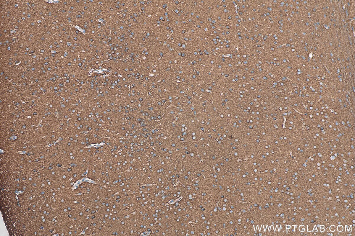 Immunohistochemistry (IHC) staining of mouse brain tissue using PACSIN1 Monoclonal antibody (68115-1-Ig)