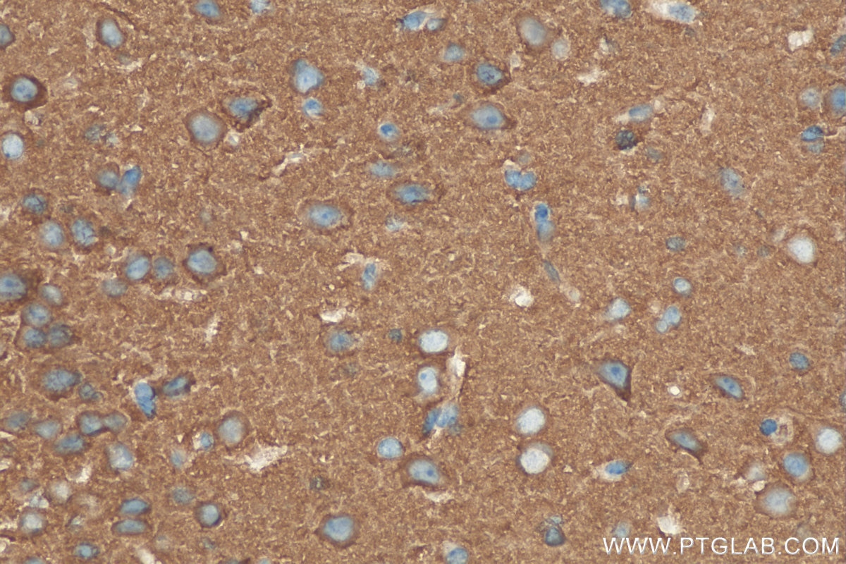Immunohistochemistry (IHC) staining of mouse brain tissue using PACSIN1 Monoclonal antibody (68115-1-Ig)