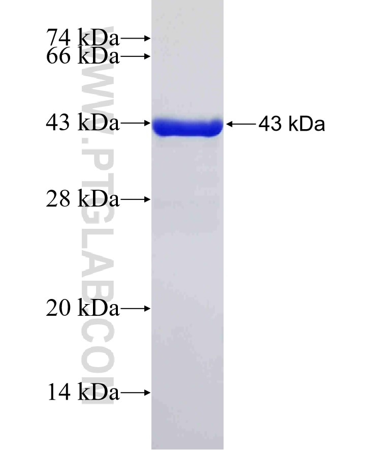 PACSIN1 fusion protein Ag4102 SDS-PAGE
