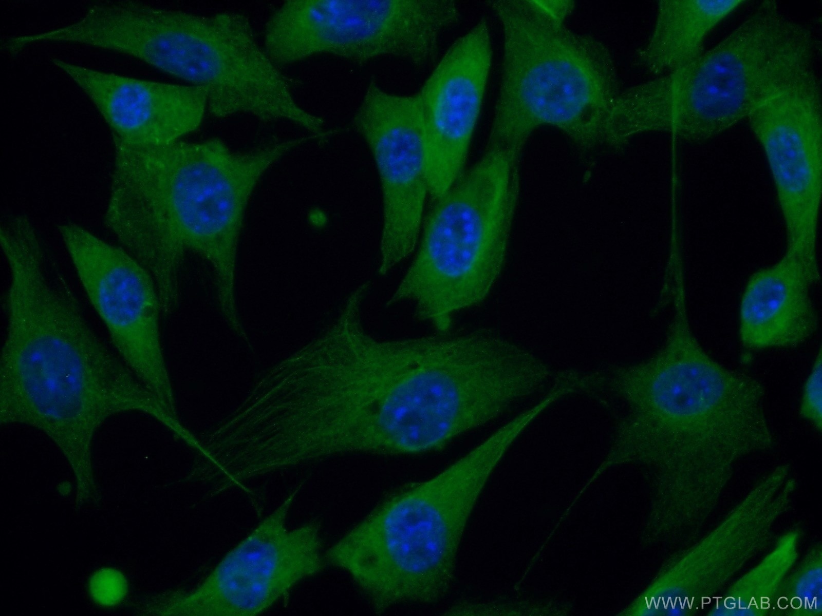 Immunofluorescence (IF) / fluorescent staining of NIH/3T3 cells using PACSIN2 Polyclonal antibody (10518-2-AP)