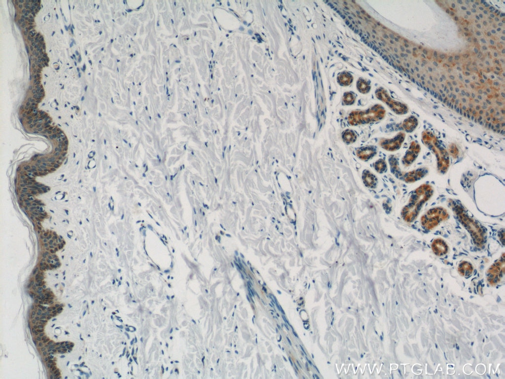 Immunohistochemistry (IHC) staining of human skin tissue using PACSIN2 Polyclonal antibody (10518-2-AP)
