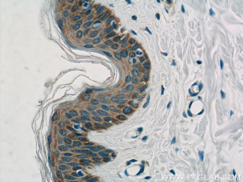 IHC staining of human skin using 10518-2-AP