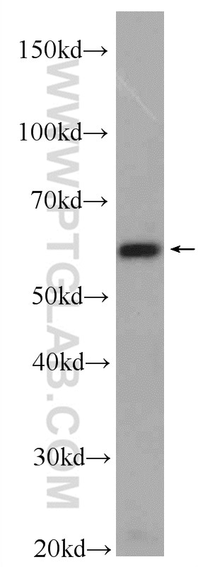 Western Blot (WB) analysis of NIH/3T3 cells using PACSIN2 Polyclonal antibody (10518-2-AP)