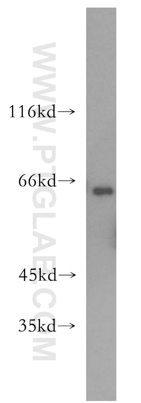 Western Blot (WB) analysis of mouse lung tissue using PACSIN2 Polyclonal antibody (10518-2-AP)