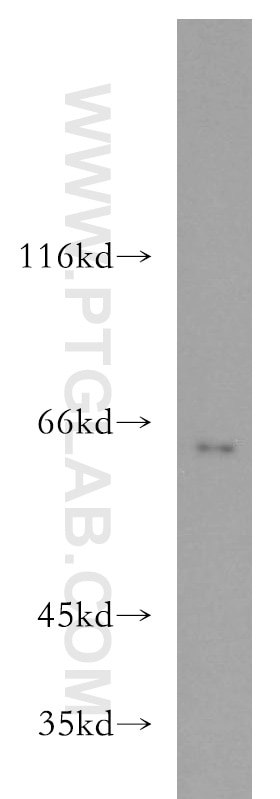 Western Blot (WB) analysis of mouse heart tissue using PACSIN2 Polyclonal antibody (10518-2-AP)