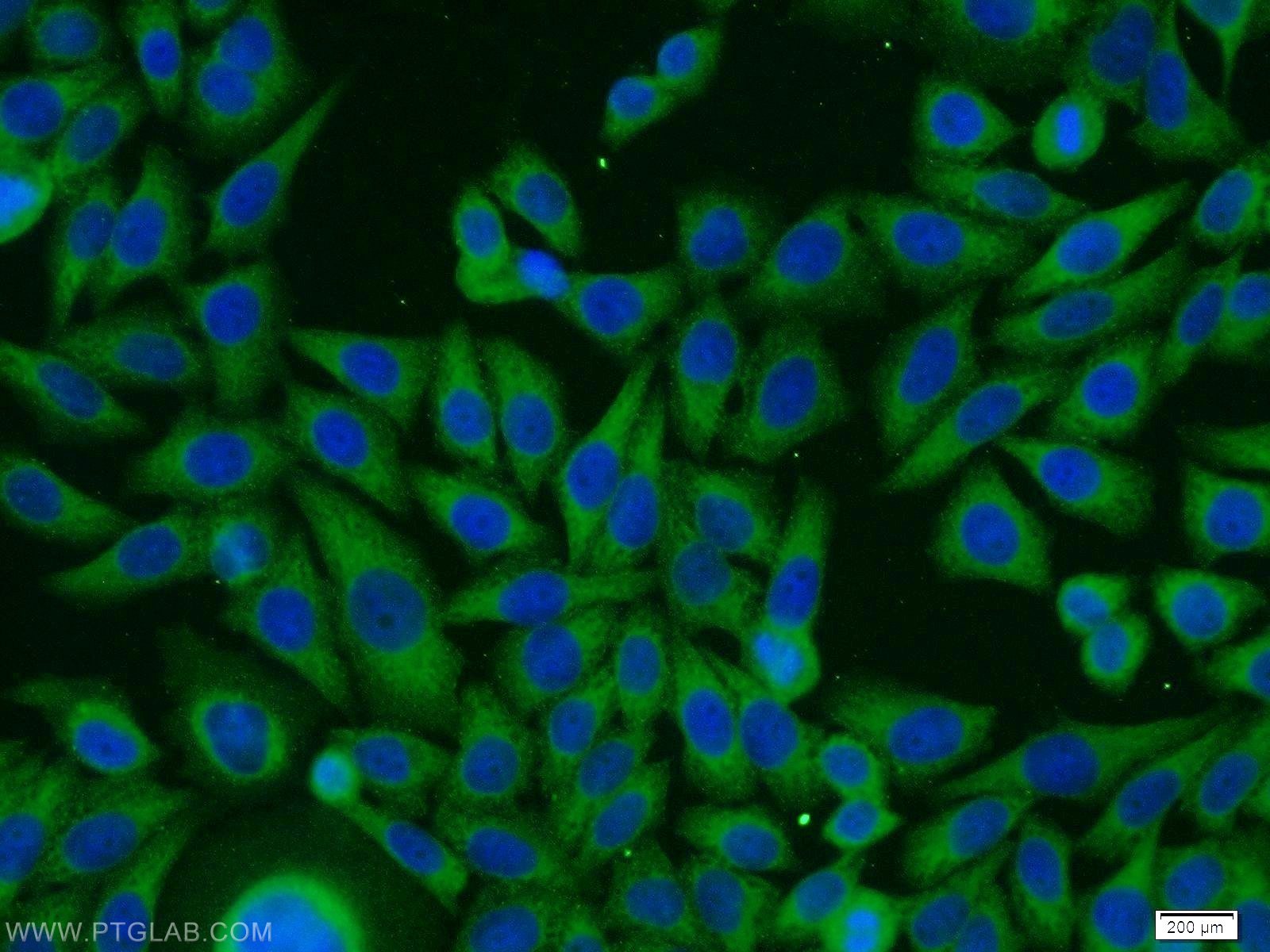 Immunofluorescence (IF) / fluorescent staining of HeLa cells using PACSIN3 Polyclonal antibody (10639-1-AP)