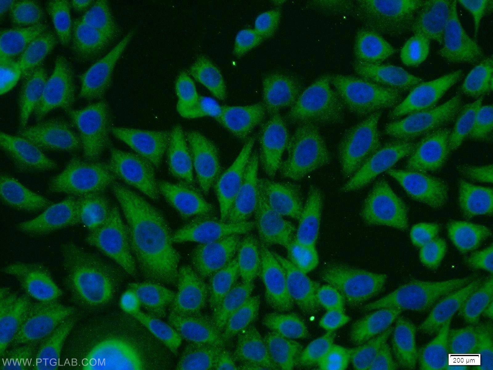 IF Staining of HeLa using 10639-1-AP