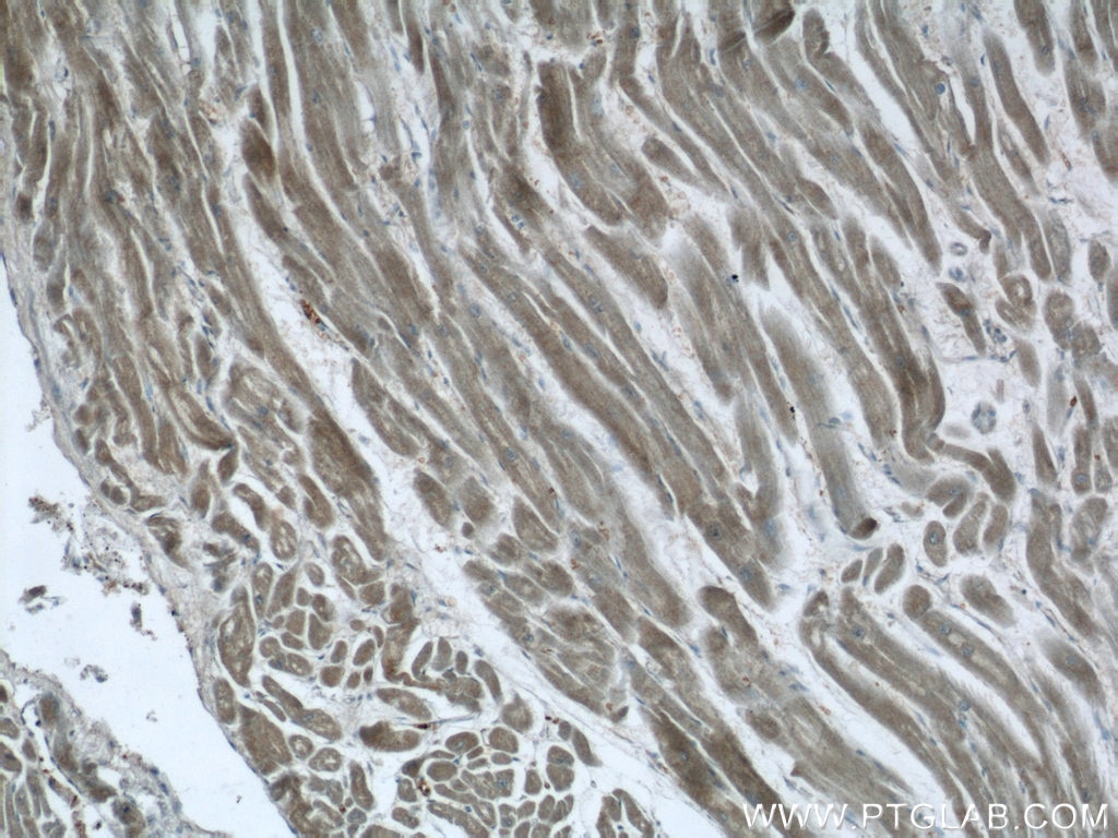 Immunohistochemistry (IHC) staining of human heart tissue using PACSIN3 Polyclonal antibody (10639-1-AP)