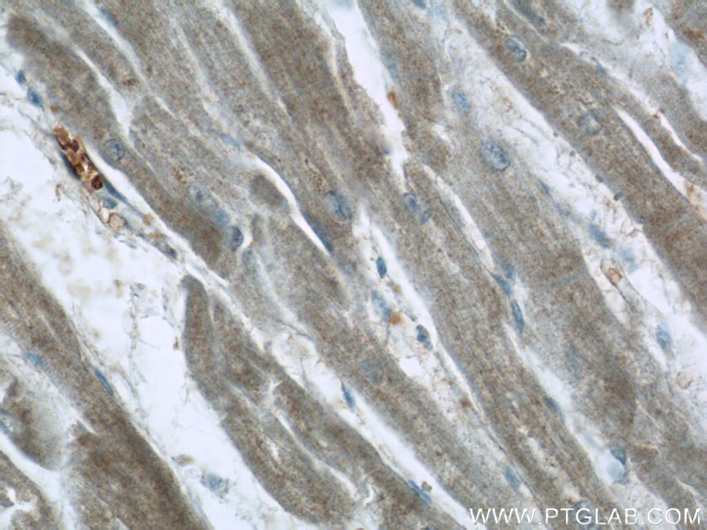 Immunohistochemistry (IHC) staining of human heart tissue using PACSIN3 Polyclonal antibody (10639-1-AP)