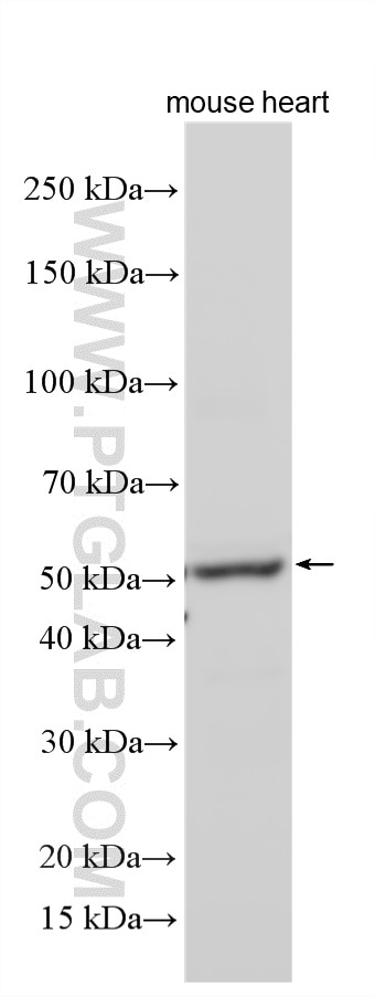 Western Blot (WB) analysis of various lysates using PACSIN3 Polyclonal antibody (10639-1-AP)