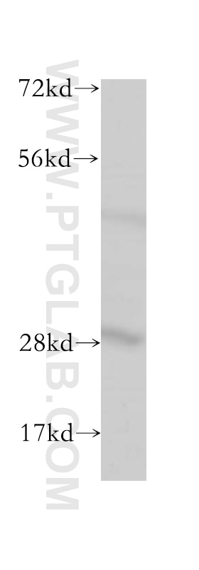 Western Blot (WB) analysis of mouse lung tissue using PACSIN3 Polyclonal antibody (10639-1-AP)