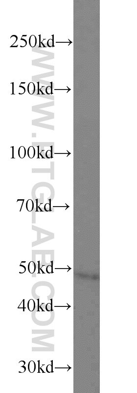 Western Blot (WB) analysis of mouse liver tissue using PACSIN3 Polyclonal antibody (10639-1-AP)