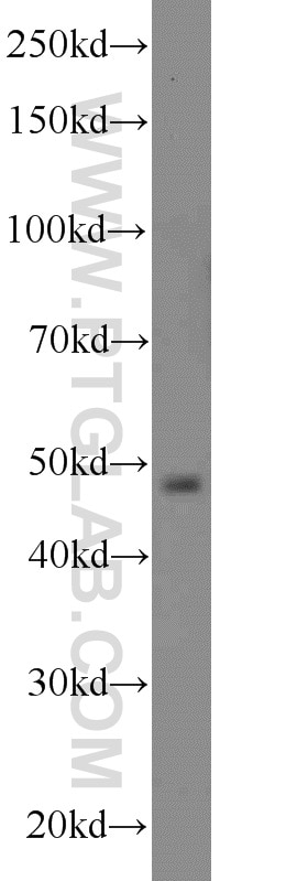 Western Blot (WB) analysis of HeLa cells using PACSIN3 Polyclonal antibody (10639-1-AP)