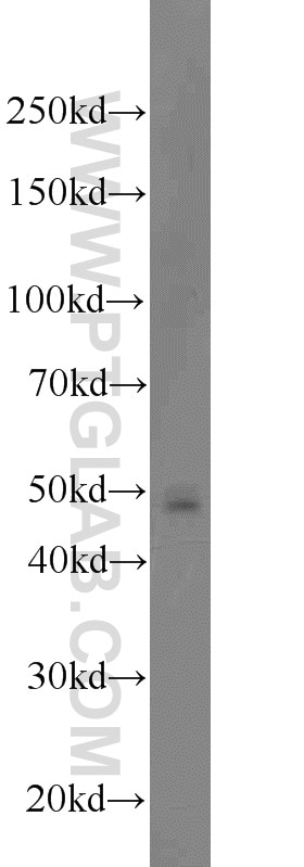 Western Blot (WB) analysis of rat brain tissue using PACSIN3 Polyclonal antibody (10639-1-AP)