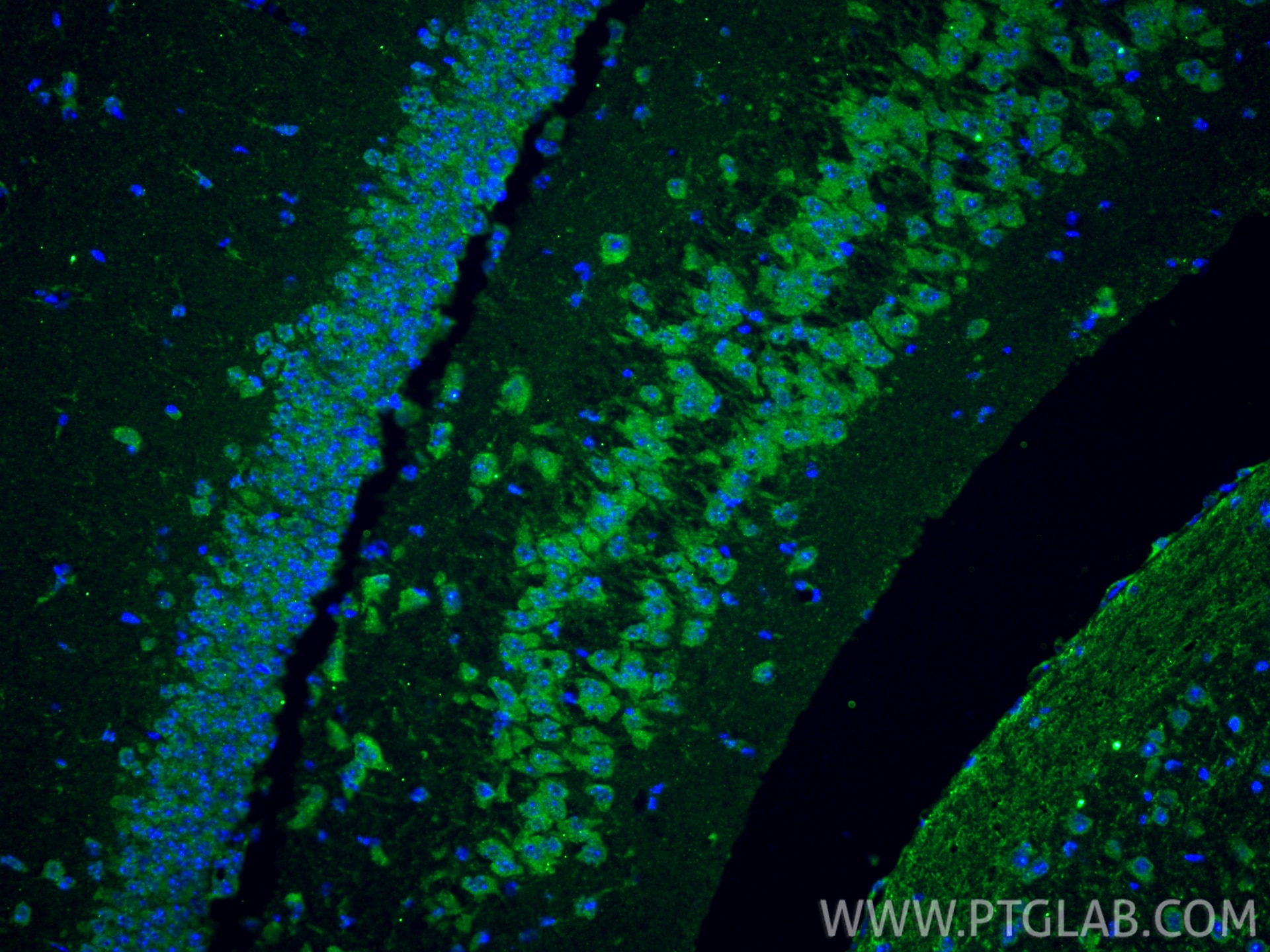 IF Staining of mouse brain using 12110-1-AP Immunofluorescence (IF) / fluorescent staining of mouse brain tissue using PADI2 Polyclonal antibody (12110-1-AP)