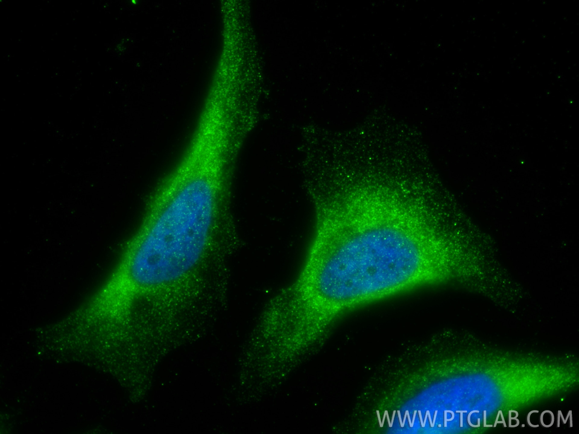 IF Staining of HeLa using 12110-1-AP Immunofluorescence (IF) / fluorescent staining of HeLa cells using PADI2 Polyclonal antibody (12110-1-AP)