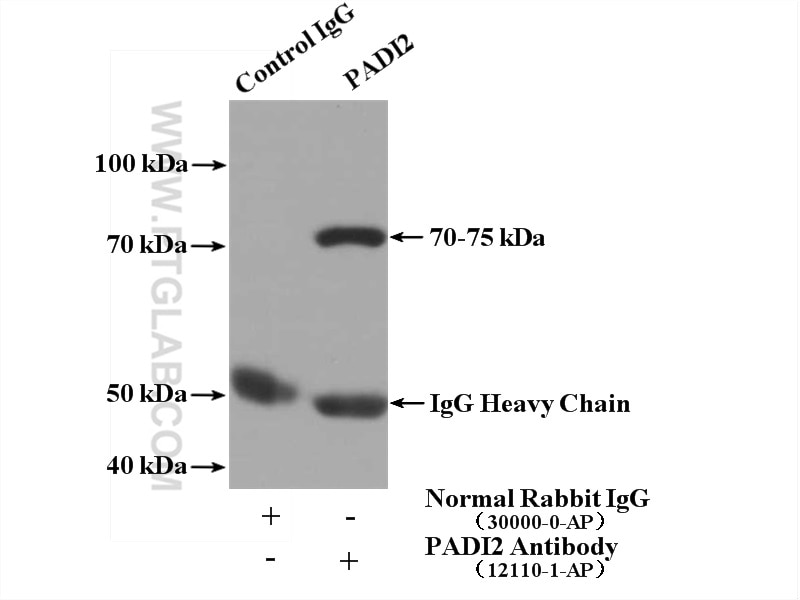 Immunoprecipitation (IP) experiment of mouse brain tissue using PADI2 Polyclonal antibody (12110-1-AP)