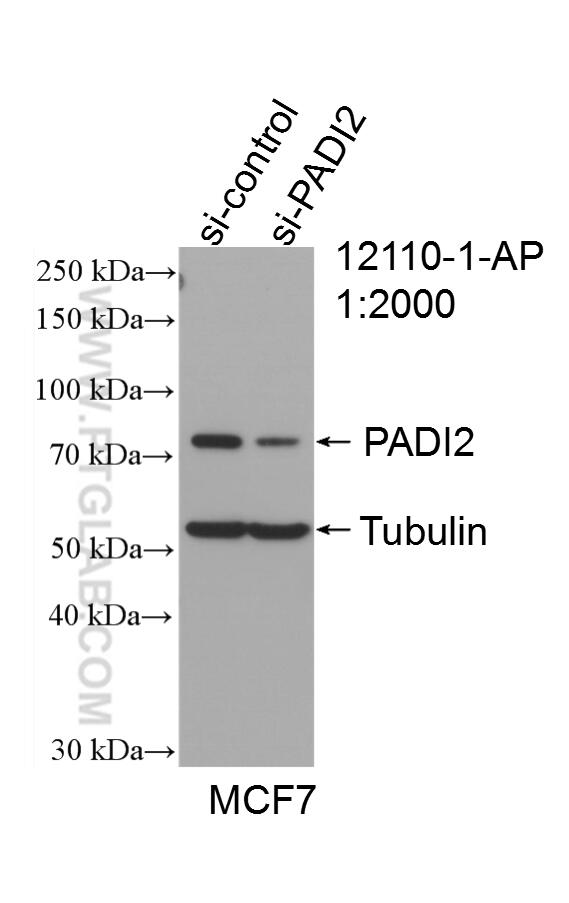 Western Blot (WB) analysis of MCF-7 cells using PADI2 Polyclonal antibody (12110-1-AP)