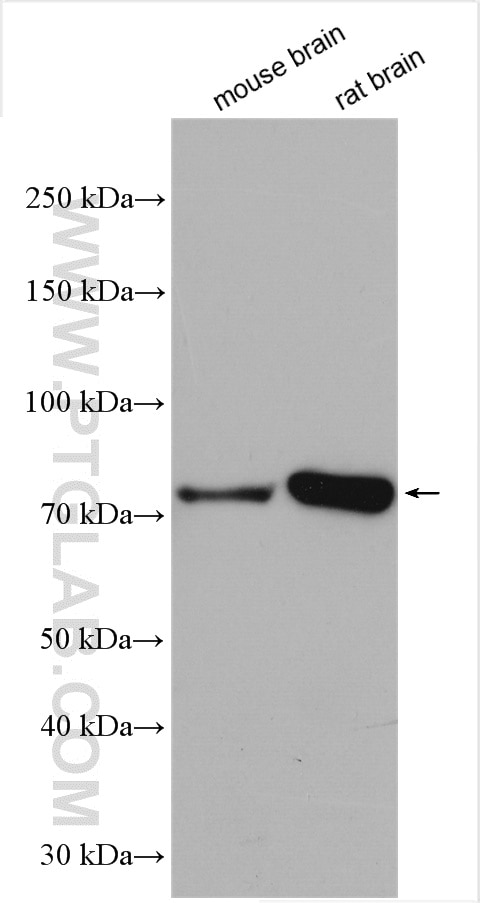 Western Blot (WB) analysis of various lysates using PADI2 Polyclonal antibody (12110-1-AP)