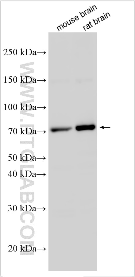 Western Blot (WB) analysis of various lysates using PADI2 Polyclonal antibody (12110-1-AP)