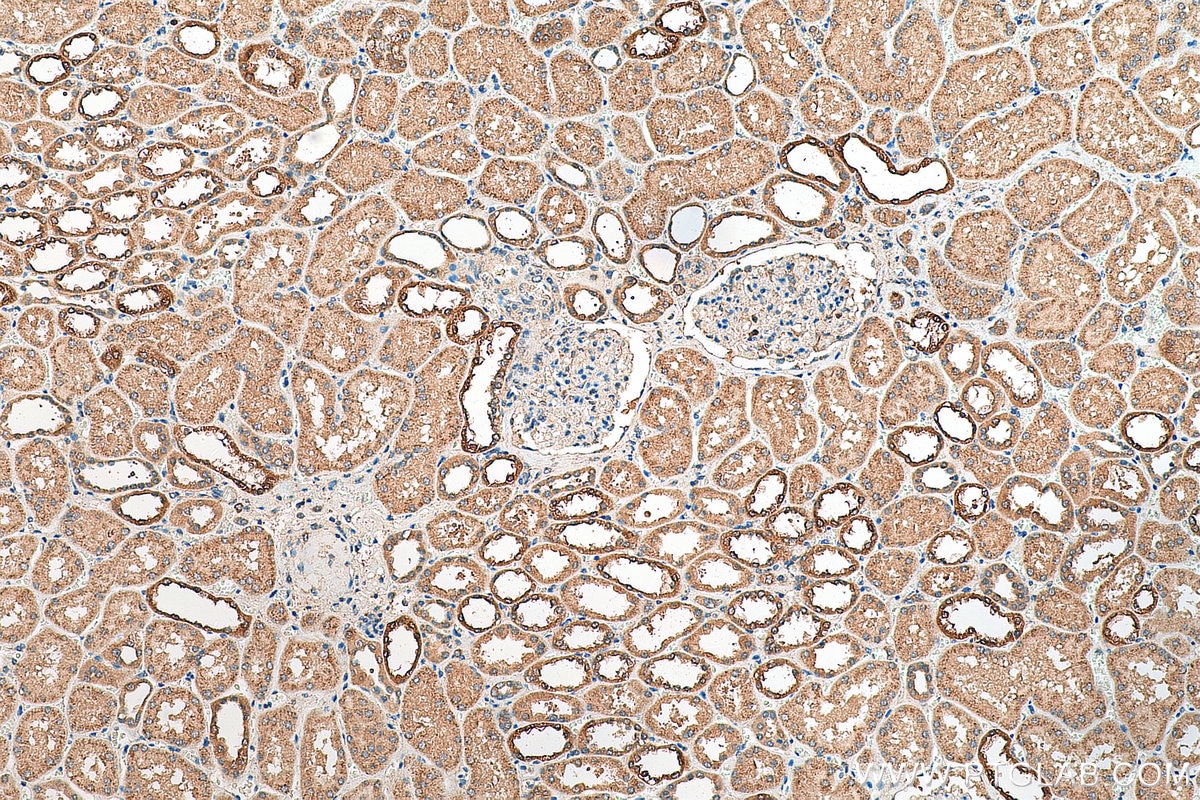 Immunohistochemistry (IHC) staining of human kidney tissue using PADI2 Polyclonal antibody (29169-1-AP)