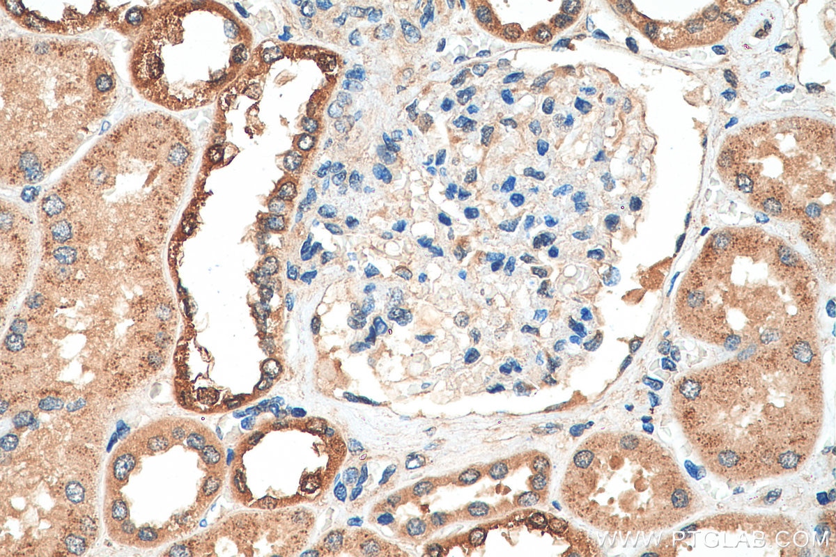 Immunohistochemistry (IHC) staining of human kidney tissue using PADI2 Polyclonal antibody (29169-1-AP)