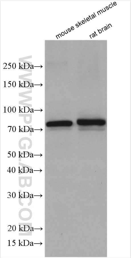 Western Blot (WB) analysis of various lysates using PADI2 Polyclonal antibody (29169-1-AP)