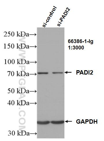 Western Blot (WB) analysis of HeLa cells using PADI2 Monoclonal antibody (66386-1-Ig)