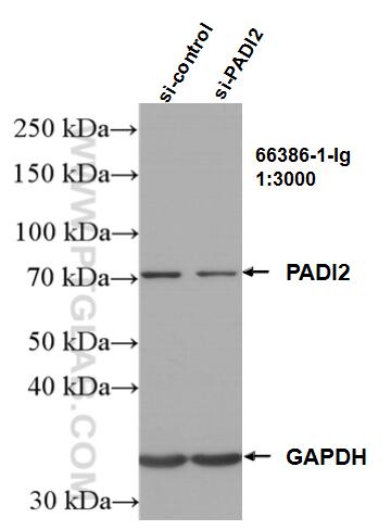 WB analysis of HeLa using 66386-1-Ig