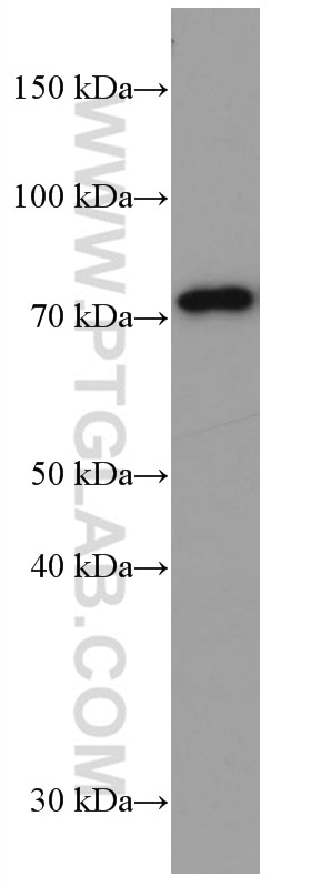 WB analysis of pig brain using 66386-1-Ig