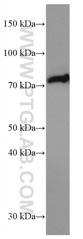 Western Blot (WB) analysis of rat brain tissue using PADI2 Monoclonal antibody (66386-1-Ig)