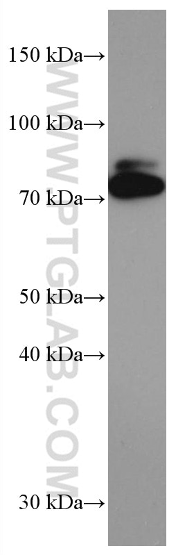 Western Blot (WB) analysis of mouse brain tissue using PADI2 Monoclonal antibody (66386-1-Ig)