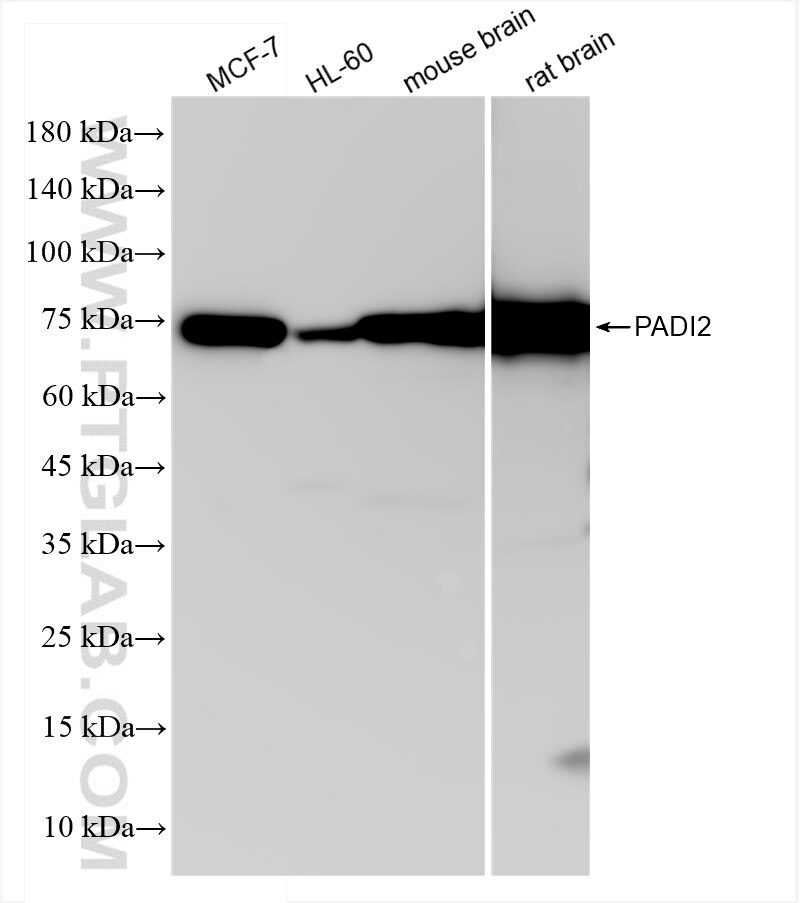 Western Blot (WB) analysis of various lysates using PADI2 Recombinant antibody (83868-1-RR)