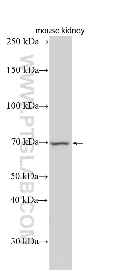 WB analysis using 33848-1-AP Western Blot (WB) analysis of various lysates using PADI3 Polyclonal antibody (33848-1-AP)