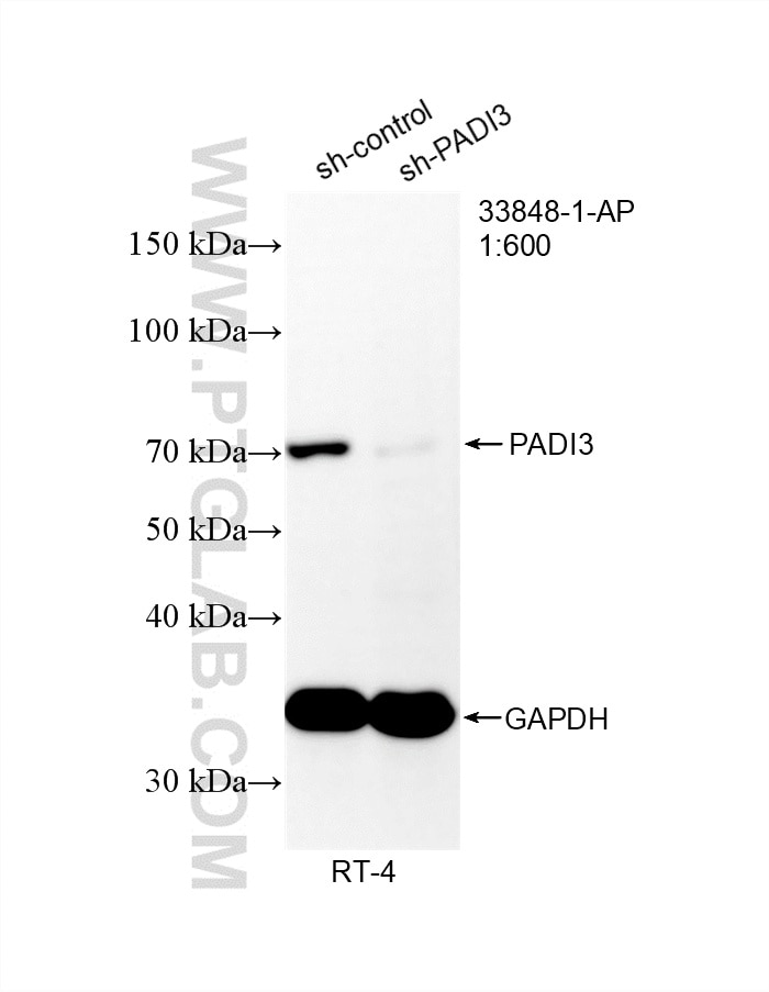 WB analysis of RT-4 using 33848-1-AP Western Blot (WB) analysis of RT-4 cells using PADI3 Polyclonal antibody (33848-1-AP)