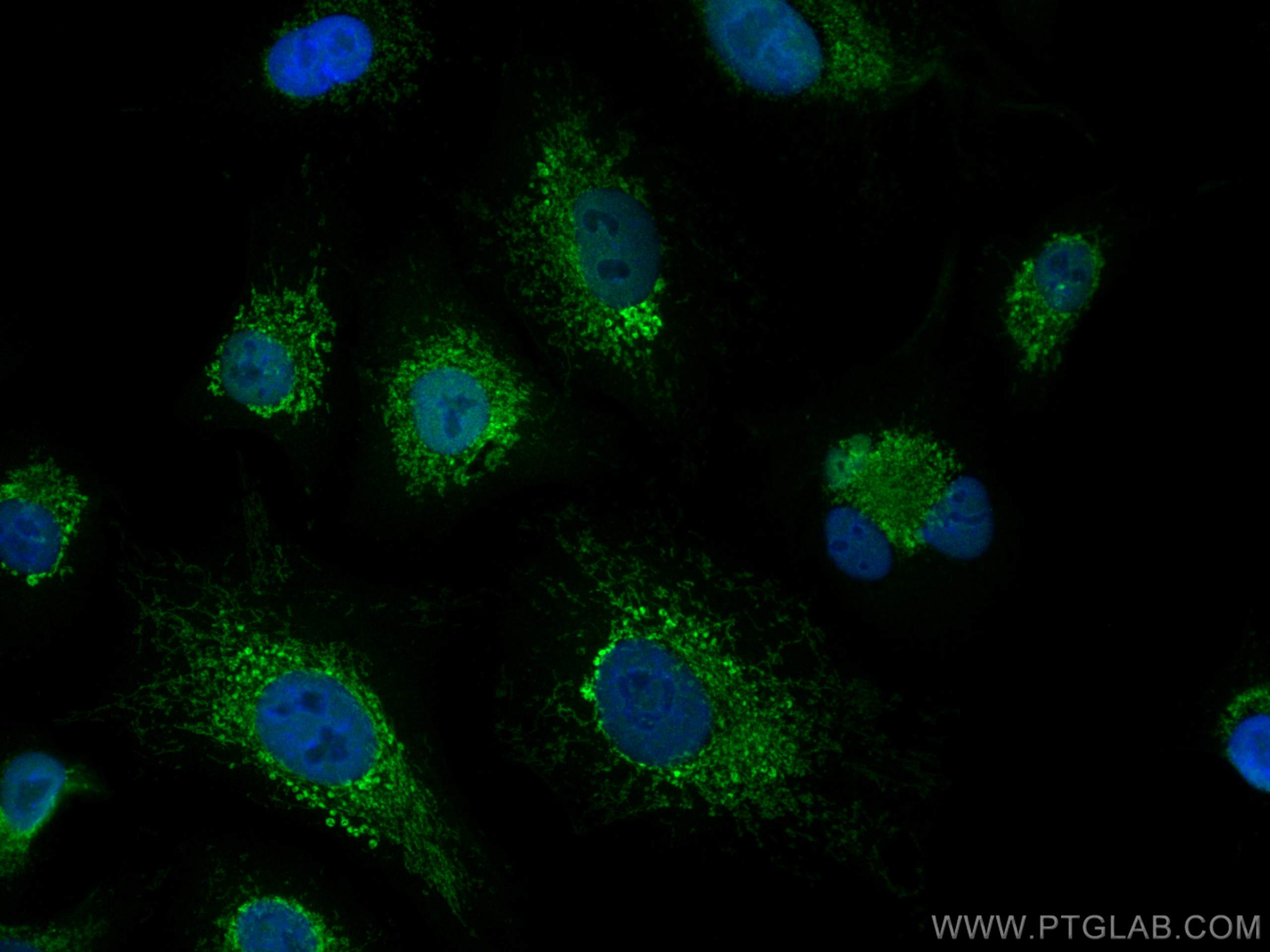 IF Staining of A549 using 17373-1-AP