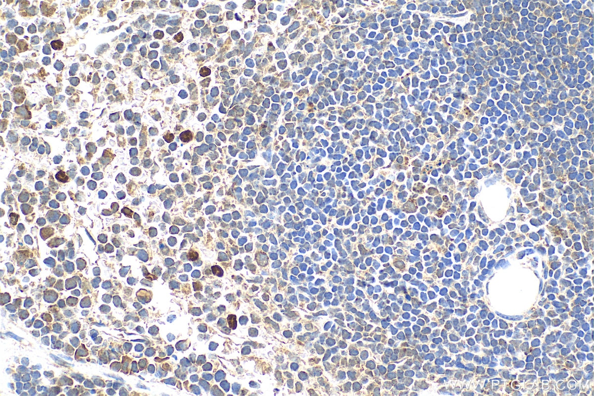 Immunohistochemistry (IHC) staining of mouse spleen tissue using PADI4 Polyclonal antibody (17373-1-AP)