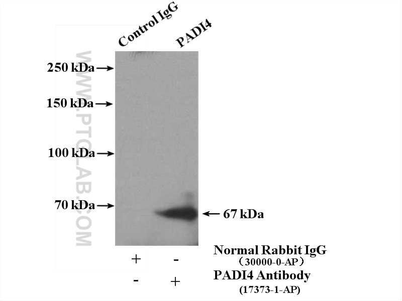 Immunoprecipitation (IP) experiment of mouse spleen tissue using PADI4 Polyclonal antibody (17373-1-AP)
